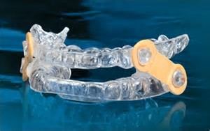 Elastic Mandibular Advancement oral appliance
