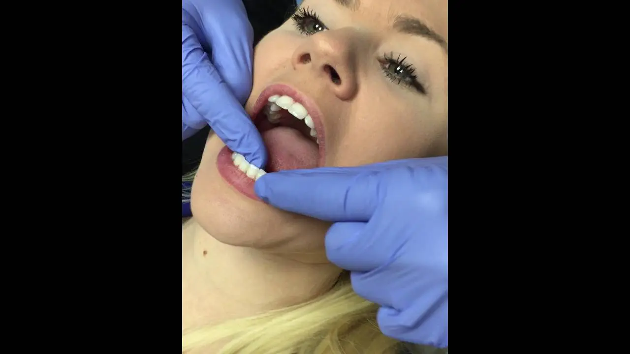 How to Floss Your Teeth Video Thumbnail